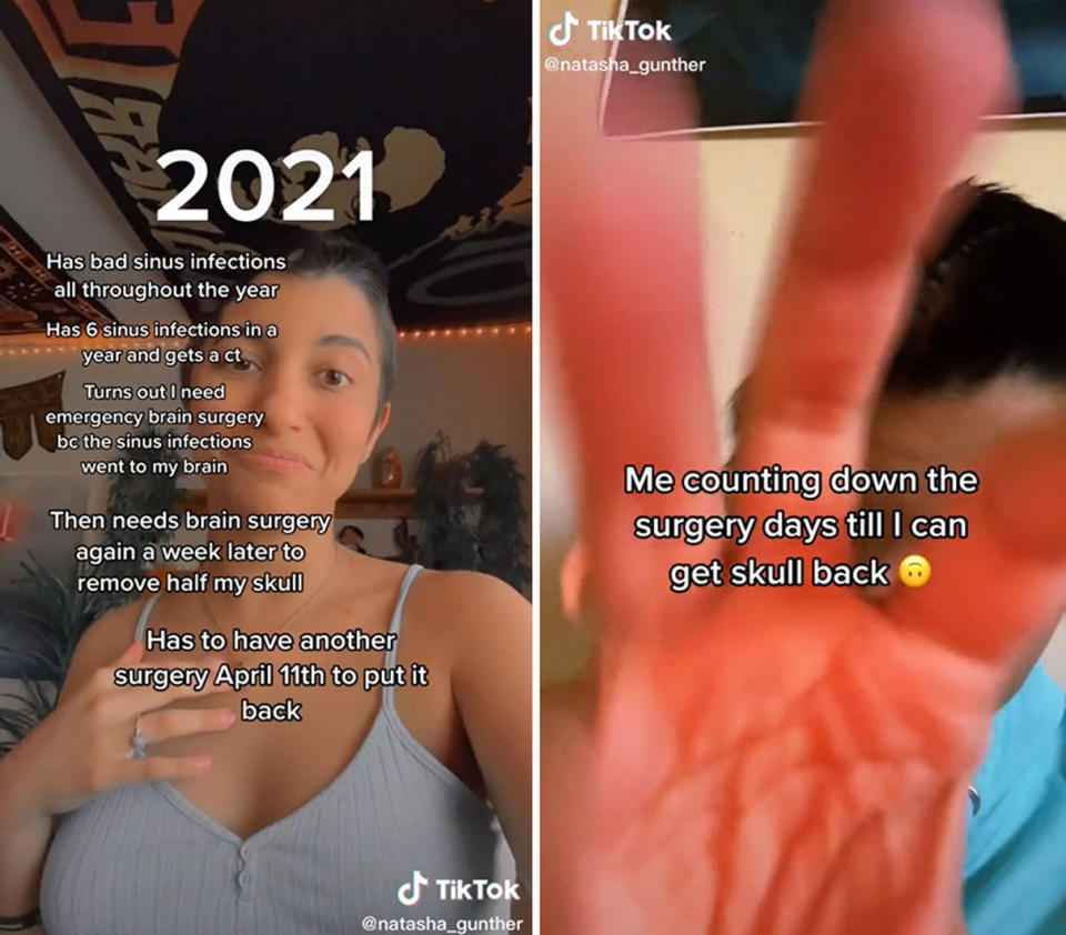 Natasha Gunther has brought awareness to the potential dangers of persistent sinus infections on TikTok. Source