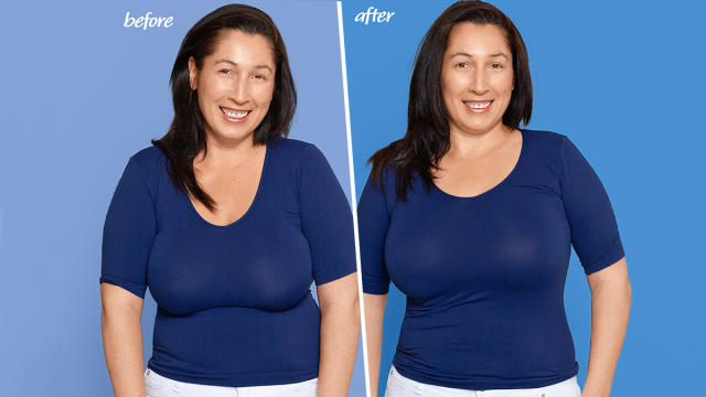 Model shows the horrifying results of wearing the wrong bra size for years,  including sagging boobs and a hunchback