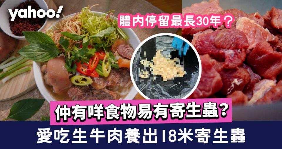 愛吃生牛肉養出18米寄生蟲 仲有咩食物易有寄生蟲？