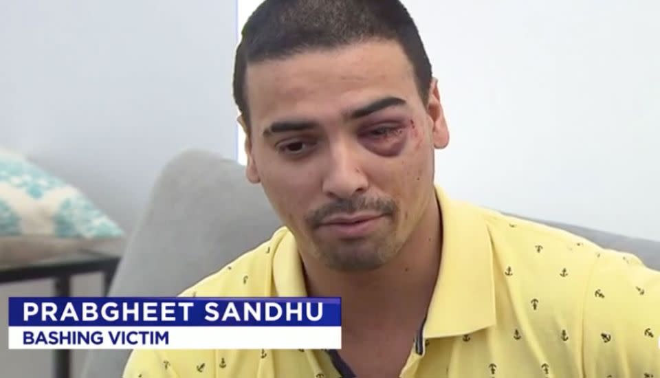 Prabgheet Sandhu was bashed after asking for loud music to be turned down. Source: 7 News