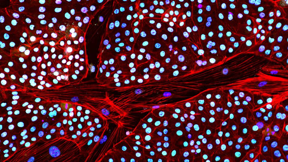 An Asian elephant stem cell line stained in different colors to highlight different elements. - Courtesy Colossal