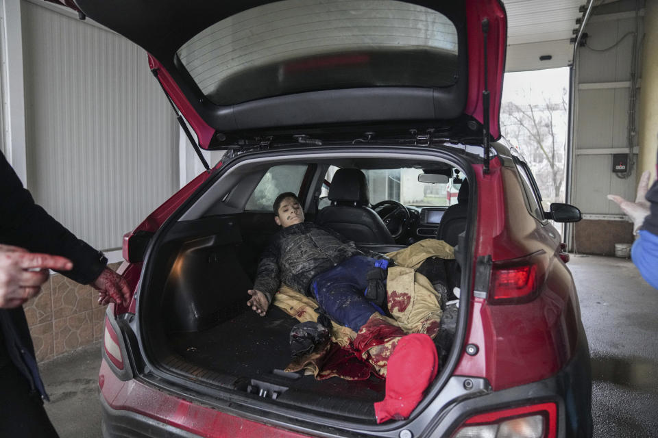 EDS NOTE: GRAPHIC CONTENT - Teenager Artyom, 15, wounded by shelling, lies in a car waiting to be moved to a maternity hospital converted into a medical ward in Mariupol, Ukraine, Wednesday, March 2, 2022. Russian forces have seized a strategic Ukrainian seaport and besieged another. Those moves are part of efforts to cut the country off from its coastline even as Moscow said Thursday it was ready for talks to end the fighting. (AP Photo/Evgeniy Maloletka)