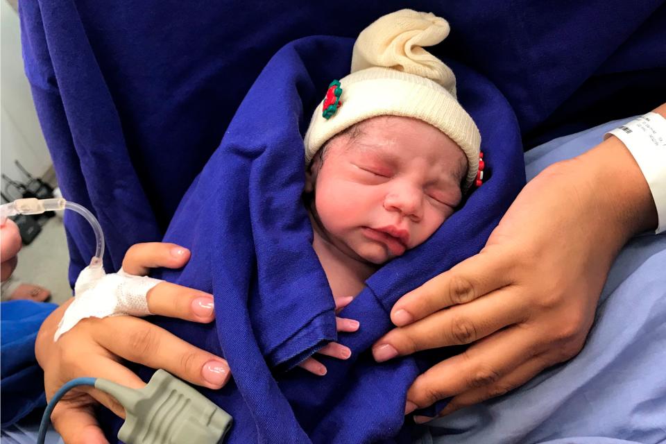 This Dec. 15, 2017 photo provided by transplant surgeon Dr. Wellington Andraus shows the baby girl born to a woman with a uterus transplanted from a deceased donor at the Hospital das Clinicas of the University of Sao Paulo School of Medicine, Sao Paulo, Brazil, on the day of her birth.