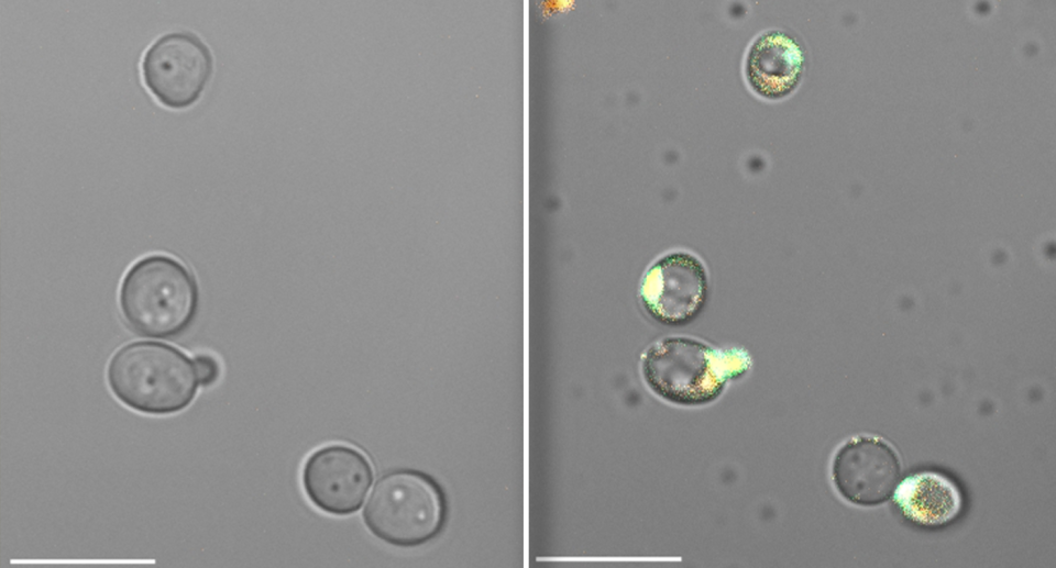 Left - Healthy fungal cells. Right - The outer membrane has turned green in parts. Small spots of orange in the same cells indicates they are dying.