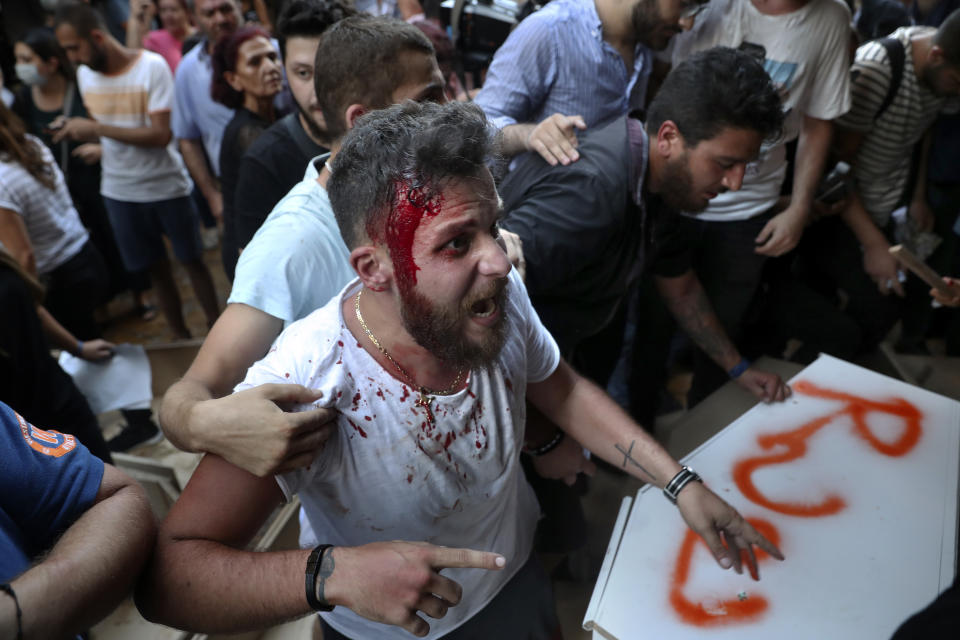 A relative of someone who was killed in last year's massive blast at Beirut's seaport bleeds during clashes with riot police as he and others try to storm the home of caretaker Interior Minister Mohamed Fehmi in Beirut, Lebanon, Tuesday, July 13, 2021. Family members are angry with Fehmi because he rejected a request by the judge investigating the explosion to question Maj. Gen. Abbas Ibrahim, who is one of Lebanon's most prominent generals and heads of the General Security Directorate. (AP Photo/Bilal Hussein)