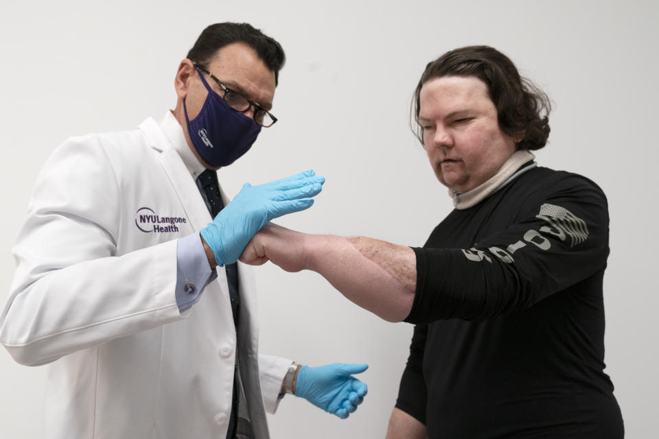 Dr. Eduardo Rodriguez has Joe DiMeo demonstrate the flexibility and strength in his hands, Monday, Jan. 25, 2021 at NYU Langone Health in New York, six months after an extremely rare double hand and face transplant. Rodriguez, who led the surgical team, said he’s amazed to see that DiMeo has been able to master skills like zipping up his jacket and putting on his shoes. “It’s very gratifying to all of us,” he said. “There’s a tremendous sense of pride.” (AP Photo/Mark Lennihan)