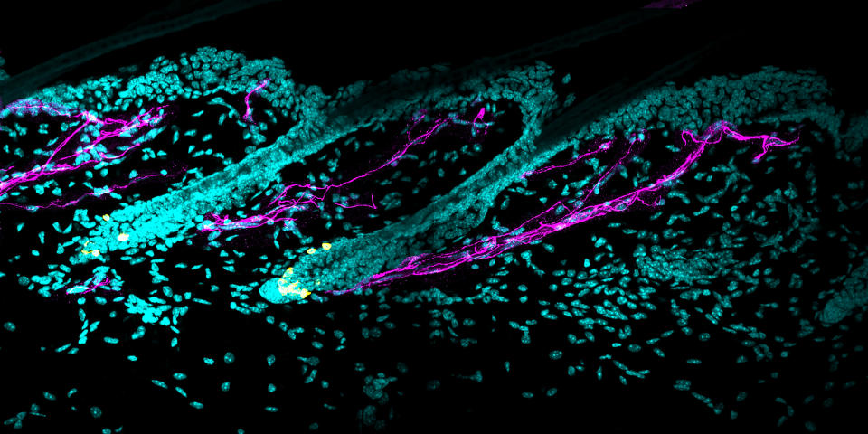 Una imagen de microscopio proporcionada por Bing Zhang y Ya-Chieh Hsu muestra los nervios simpáticos (en magenta) rodeando las células madre melanocíticas (en amarillo). (Bing Zhang y Ya-Chieh Hsu vía The New York Times)