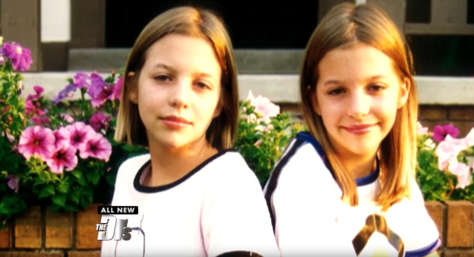 The twins in their youth. (Photo: CBS)