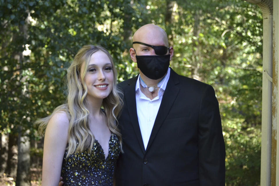 This family photo shows Aaron James and his daughter, Allie in September 2022. Aaron was working for a power line company in June 2021 when he was shocked by a live wire. He nearly died. Ultimately he lost his left arm, requiring a prosthetic. His damaged left eye was so painful it had to be removed. Multiple reconstructive surgeries couldn’t repair extensive facial injuries including his missing nose and lips. (NYU Langone Health via AP)