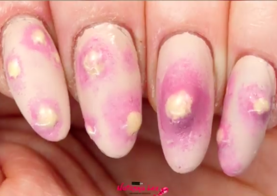 Exploding pimple nails for halloween. Photo: Instagram