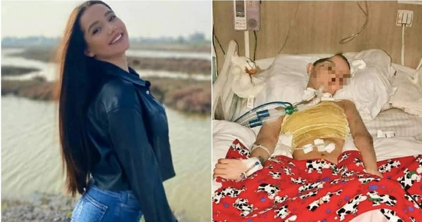 土耳其24歲女子迪拉拉騎乘機車未戴安全帽，發生車禍造成腦部重大損傷。（圖／翻攝自推特）