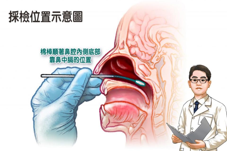 確實掌握快篩棒進入鼻腔的位置，檢測結果才會準確。（記者徐義雄攝）