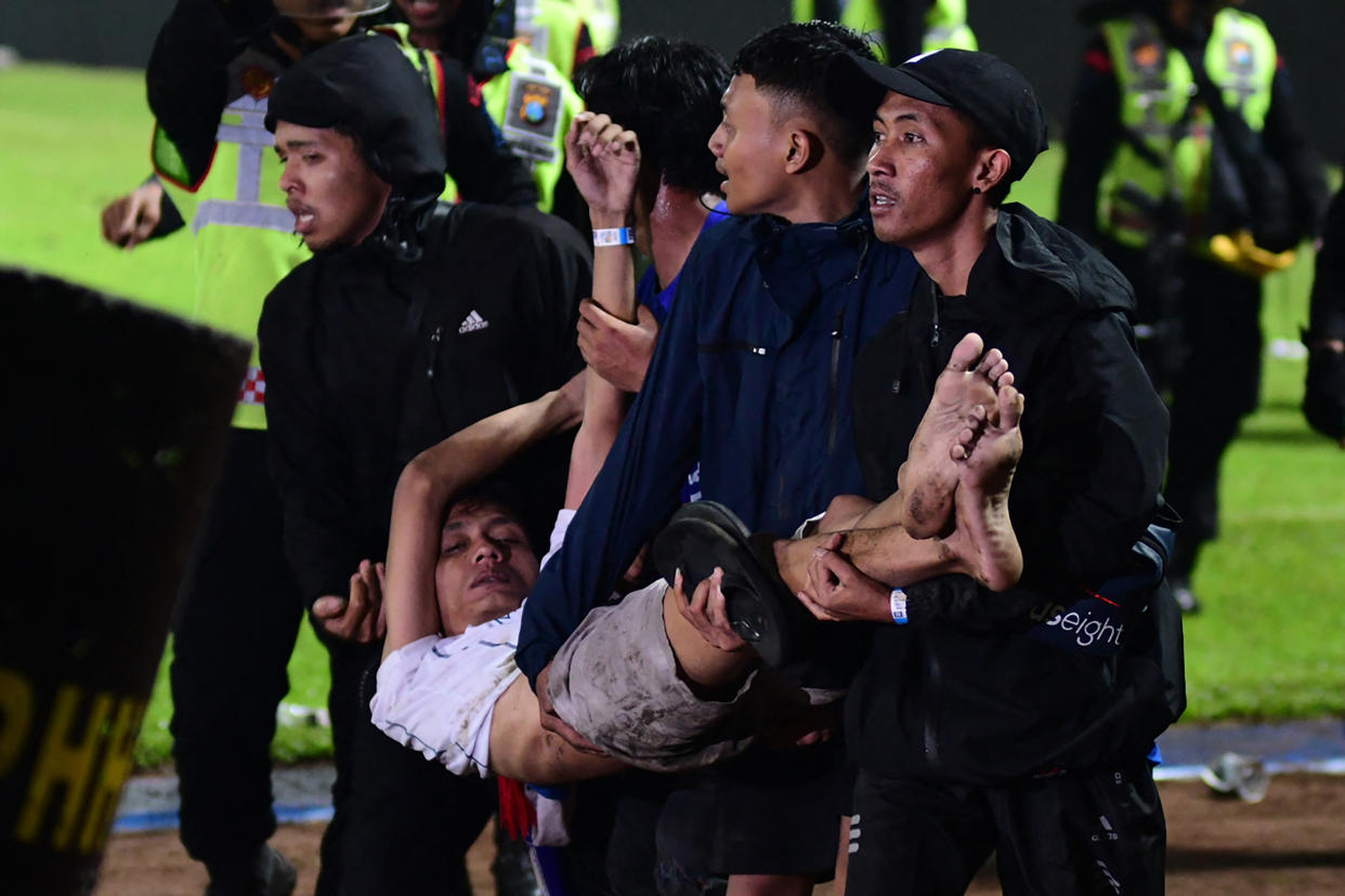Un grupo de personas lleva a un hombre después de un partido de fútbol en el estadio Kanjuruhan en Indonesia. Al menos 125 personas murieron cuando los fanáticos invadieron el campo y la policía respondió con gases lacrimógenos, lo que provocó una estampida. (Foto: AFP a través de Getty Images)
