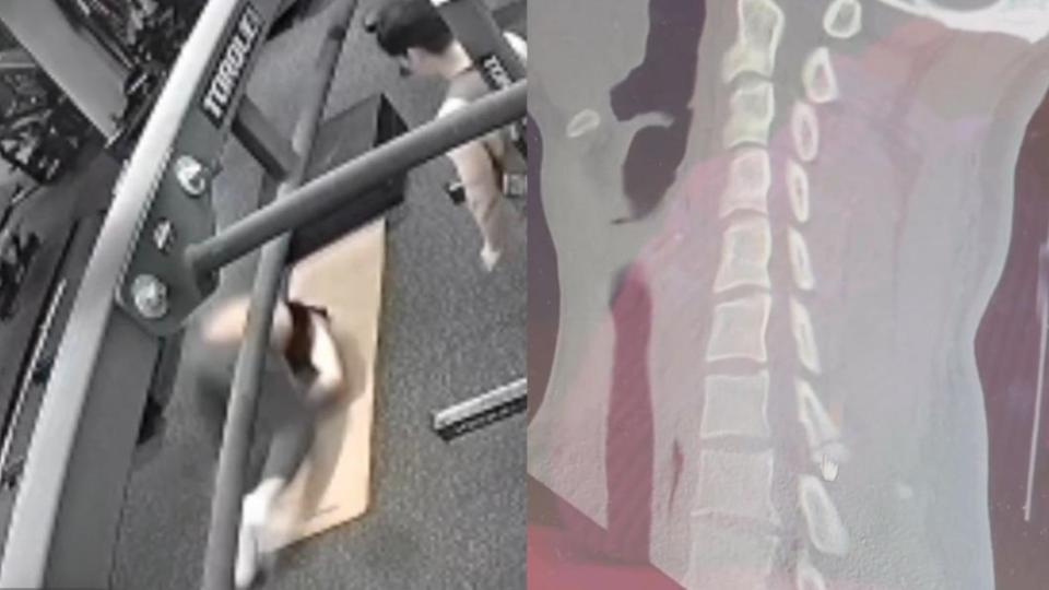 Peeta葛格今早練習後空翻時重摔在地，好在照X光後僅是骨頭裂開。（圖／翻攝自peeta.gege的IG）