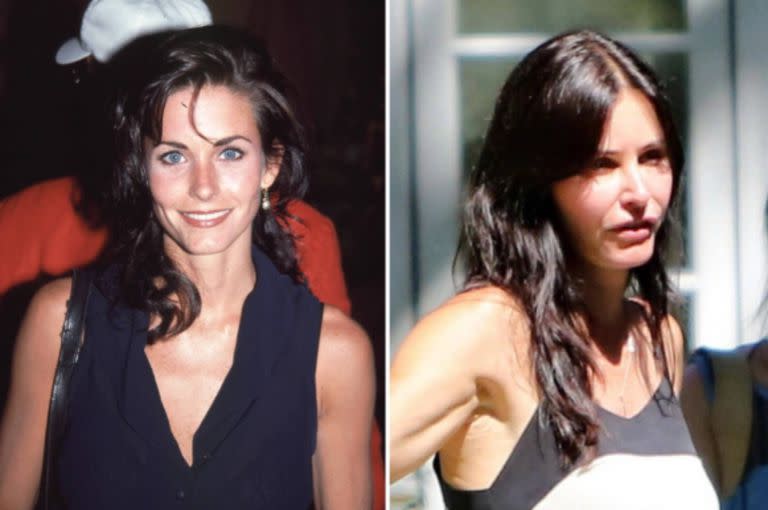 Courtney Cox se arruinó la cara con la cantidad de capas de relleno que se colocó durante una época.