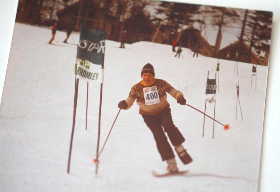 About 30 years ago, Bruno Richter, now 92, skied with his left leg in a cast after rupturing his Achilles tendon. "I'm a good enough skier that I could do that all winter," he said. This photo was taken at Okemo in Vermont.