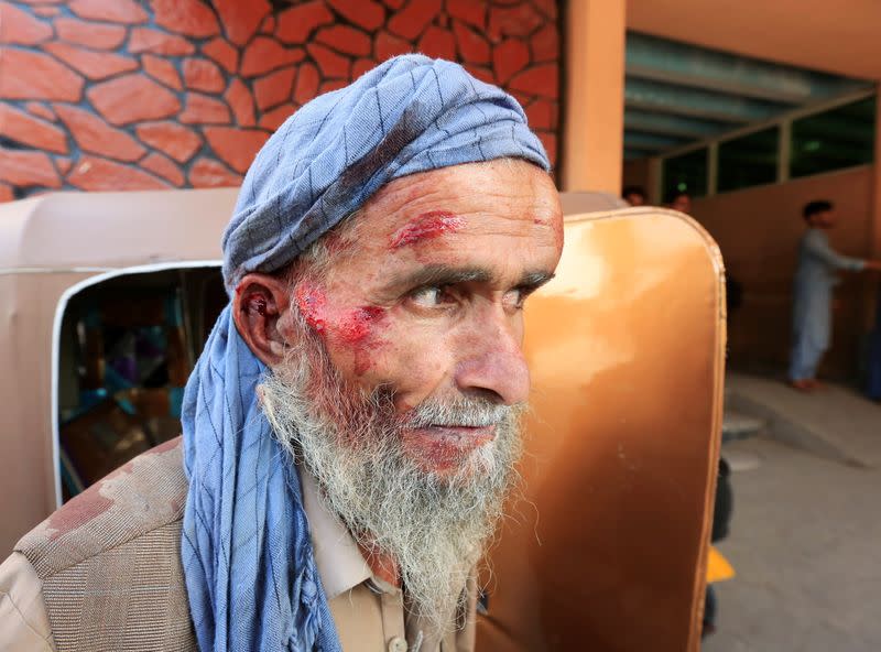 An Afghan man who got injured while collecting tokens needed to apply for the Pakistan visa, arrives for treatment at a hospital in Jalalabad