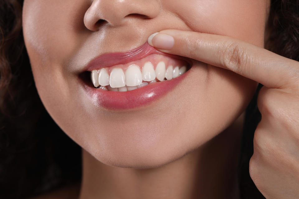 Unas encías sanas ameritan la visita frecuente al odontólogo y una buena higiene bucal. (Getty Creative)