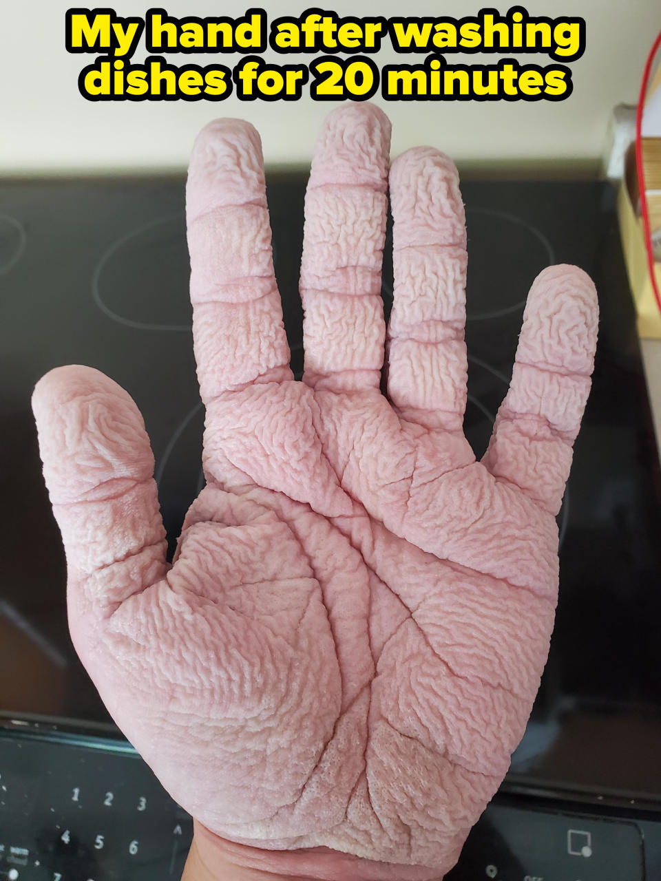 A very wrinkly hand