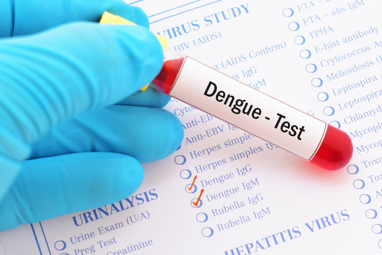 Blood sample with requisition form for dengue virus test