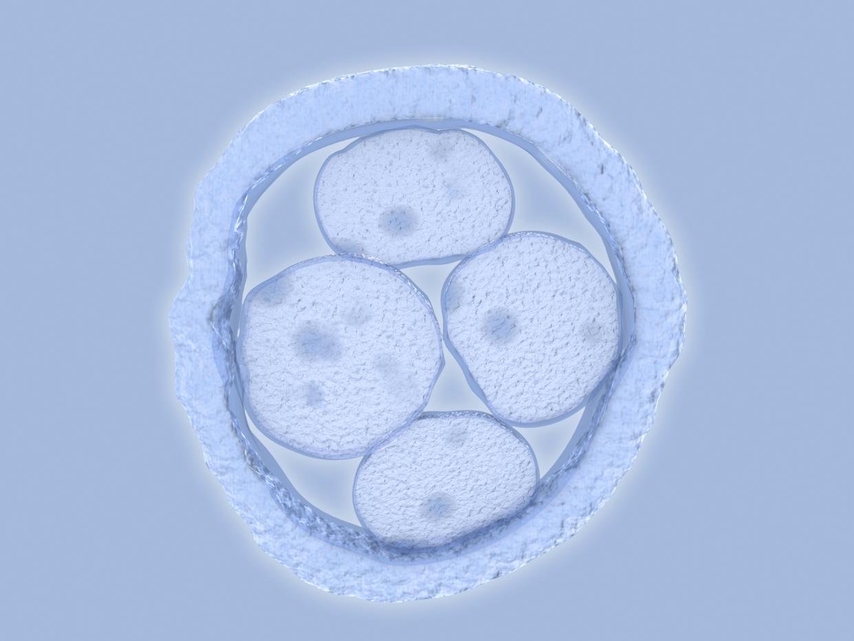 When a couple goes through a divorce, what happens to their frozen embryos? Experts say the outcome can vary. (Photo: Getty Creative)