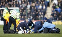 Football Soccer - Colchester United v Tottenham Hotspur - FA Cup Fourth Round - Weston Homes Community Stadium - 30/1/16 Colchester United's Alex Wynter receives treatment after sustaining an injury Action Images via Reuters / Paul Childs Livepic EDITORIAL USE ONLY. No use with unauthorized audio, video, data, fixture lists, club/league logos or "live" services. Online in-match use limited to 45 images, no video emulation. No use in betting, games or single club/league/player publications. Please contact your account representative for further details.