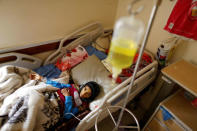 A girl lies on a bed at a cancer treatment center in Sanaa, Yemen, February 11, 2017. REUTERS/Khaled Abdullah