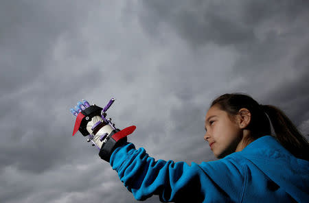 FILE PHOTO: Kylie Wicker tries on a prosthetic hand at Boylan Catholic High School in Rockford, Illinois, May 2, 2014. REUTERS/Jim Young/File Photo