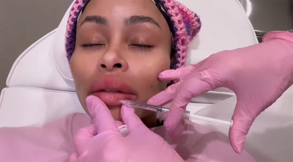 Blac Chyna getting her lip filler removed. (Blac Chyna / Instagram)