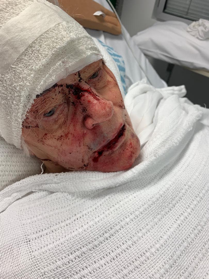 Sydney woman Patricia lays in her hospital bed with bloody injuries inflicted on her face. Her head has been bandaged up.