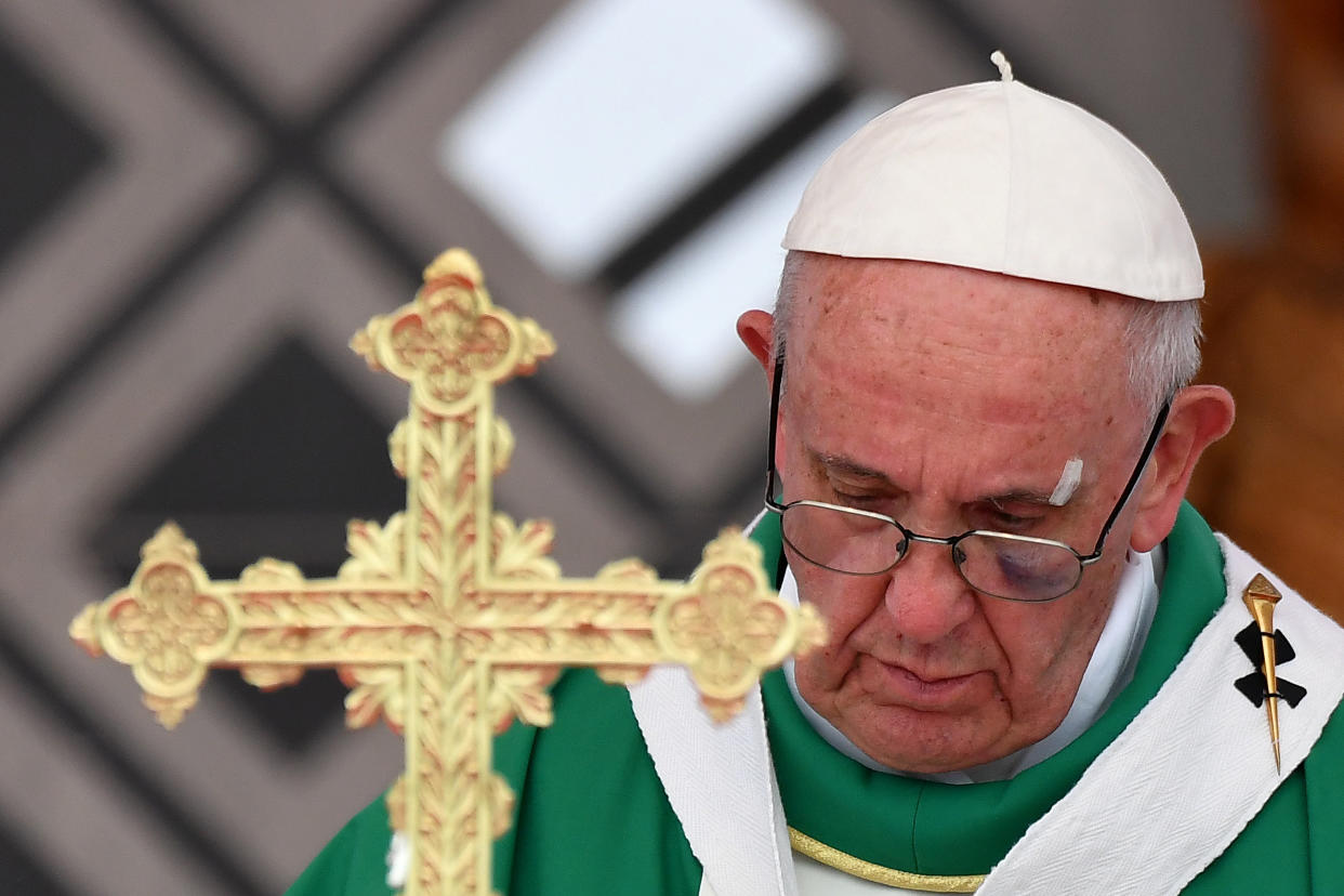 The pontiff has <a href="http://www.latimes.com/world/europe/la-fg-pope-conservatives-2017-story.html" target="_blank">long faced backlash from conservatives in the church</a> over some of his more progressive teachings. (Photo: ALBERTO PIZZOLI via Getty Images)