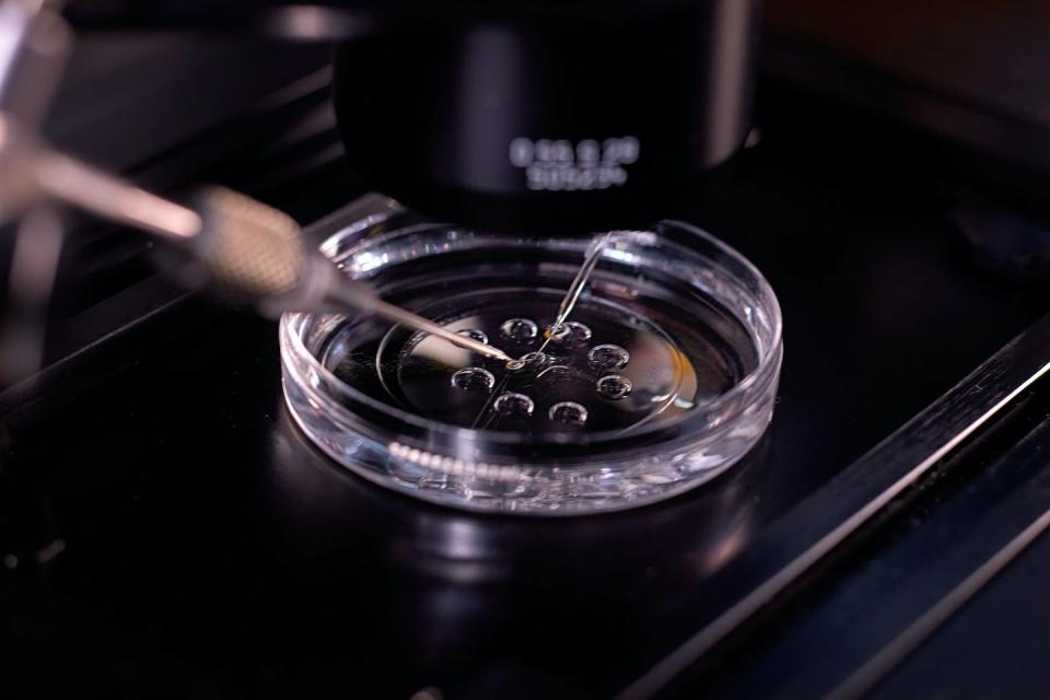 IVF may involve transferring more than one embryo at a time. <a href="https://www.gettyimages.com/detail/photo/in-vitro-fertilization-royalty-free-image/1272954210" rel="nofollow noopener" target="_blank" data-ylk="slk:Antonio Marquez lanza/Moment via Getty Images;elm:context_link;itc:0;sec:content-canvas" class="link ">Antonio Marquez lanza/Moment via Getty Images</a>