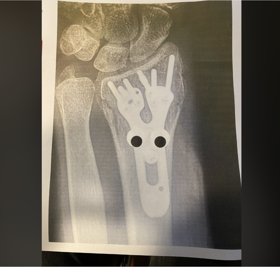 googly eyes on an X-ray