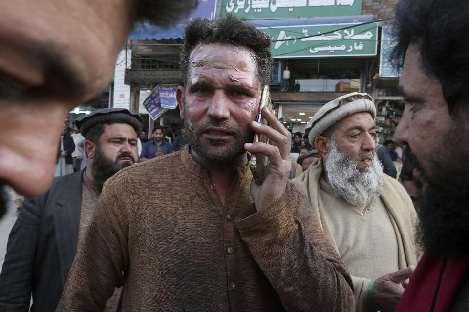 An injured victim of a suicide bombing talks on his mobile phone after getting initial treatment outside a hospital in Peshawar, Pakistan, Monday, Jan. 30, 2023. A suicide bomber struck Monday inside a mosque in the northwestern Pakistani city of Peshawar, killing multiple people and wounding scores of worshippers, officials said. (AP Photo/Muhammad Sajjad)