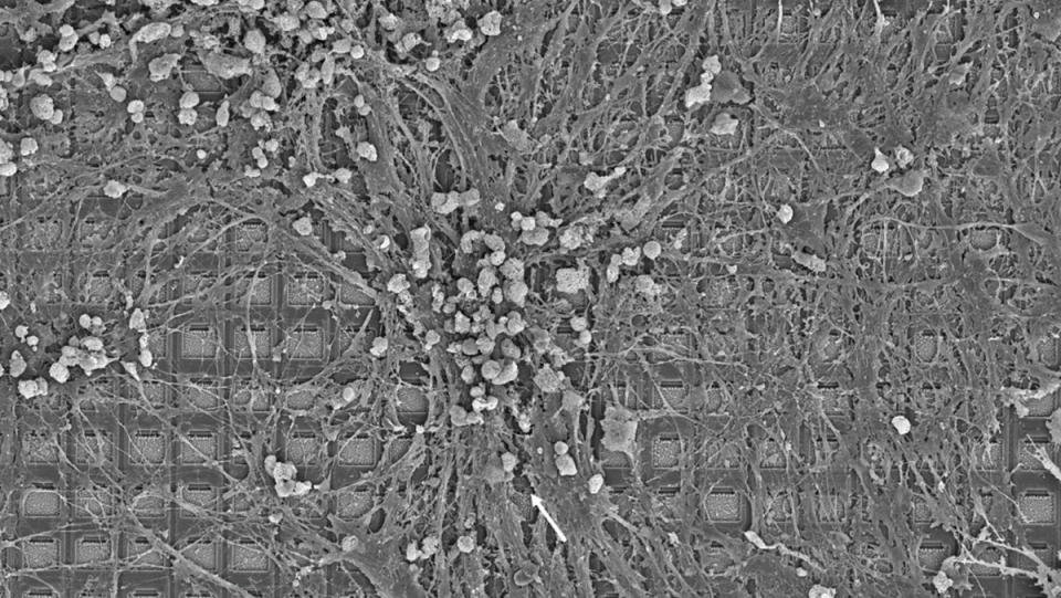 A silicon computer chip coated with human brain cells