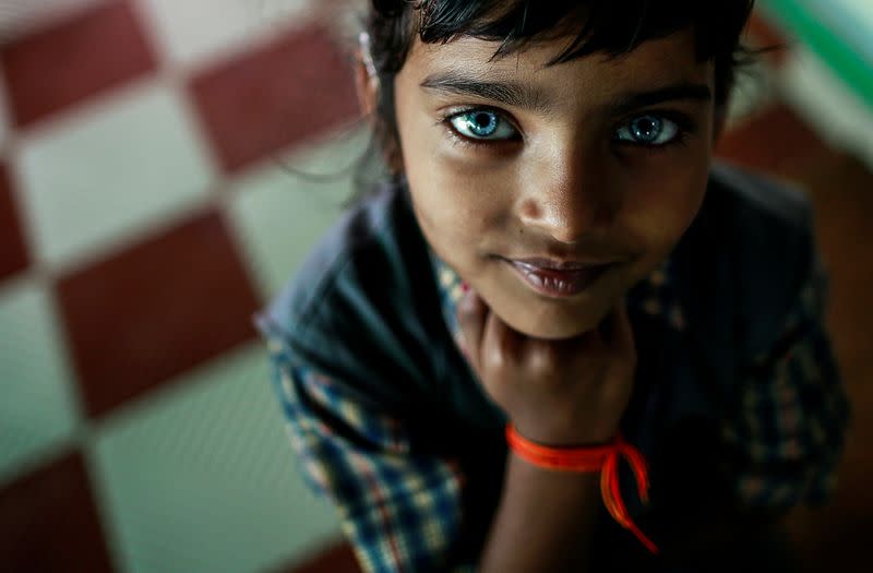 FILE PHOTO: File photo of a girl who suffers from hearing and speech disorders reacting to the camera at a rehabilitation centre for children who were born with mental and physical disabilities in Bhopal