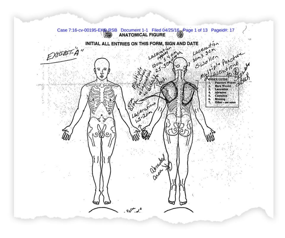 An anatomical chart shows multiple lacerations on the leg, hand, shoulders, and head.