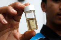 A member of a pest control team shows a container of mosquito larvae that they collected during their inspections at Zika clusters in Singapore September 5, 2016. REUTERS/Edgar Su