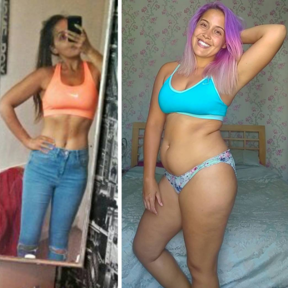 Tras superar la anorexia, así celebra las curvas de su cuerpo