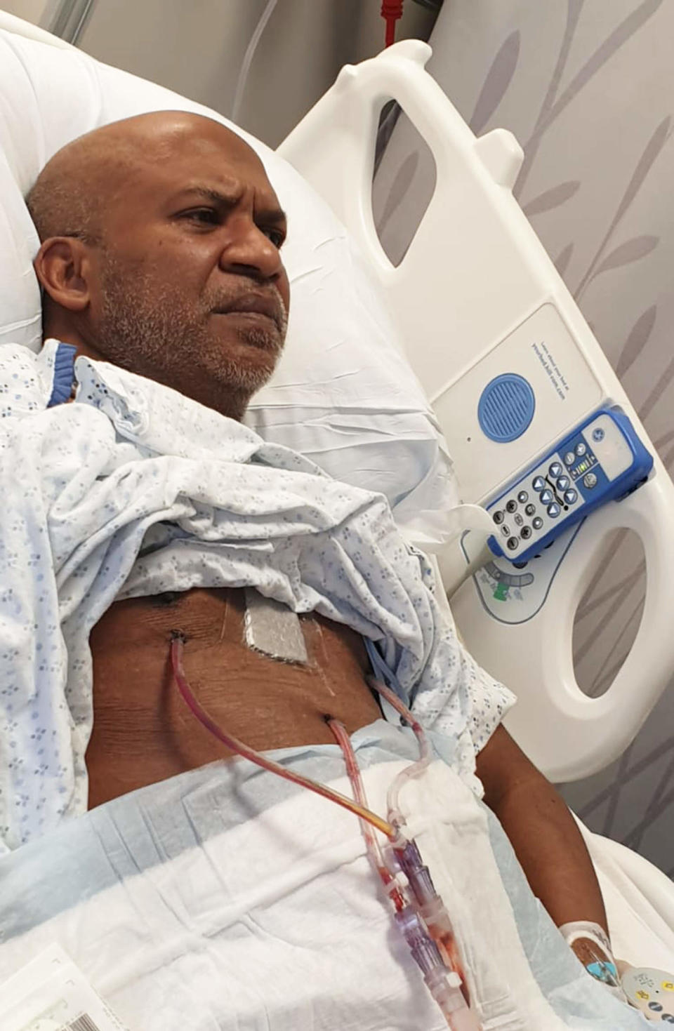 Reish Baboolal struggled while he was recovering in the intensive care unit. When he was able to move to a regular room after his bypass surgery, he felt better.  (Courtesy Reish Baboolal)