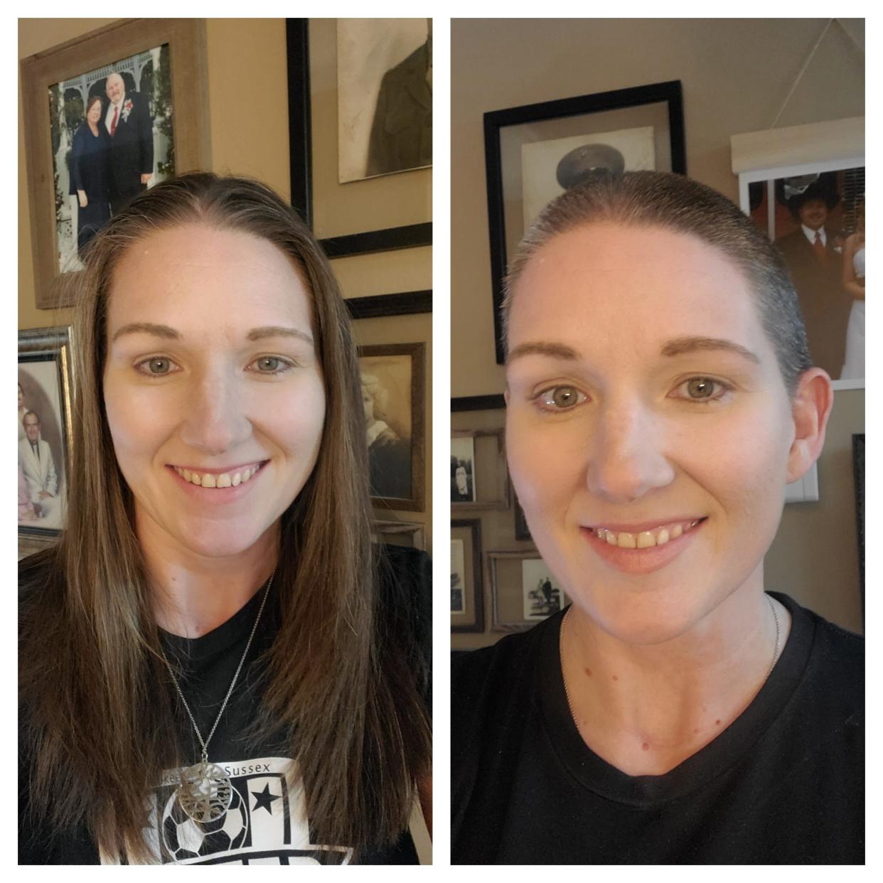 Lannon Village Trustee Amy Martin shaved her head to support her best friend, Sussex Village Trustee Stacy Riedel, who was diagnosed with inflammatory breast cancer in March.
