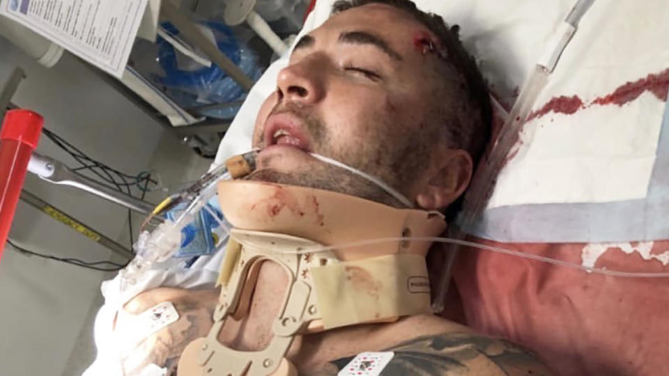 Joel Thompson, pictured in hospital after an accident on the Central Coast.