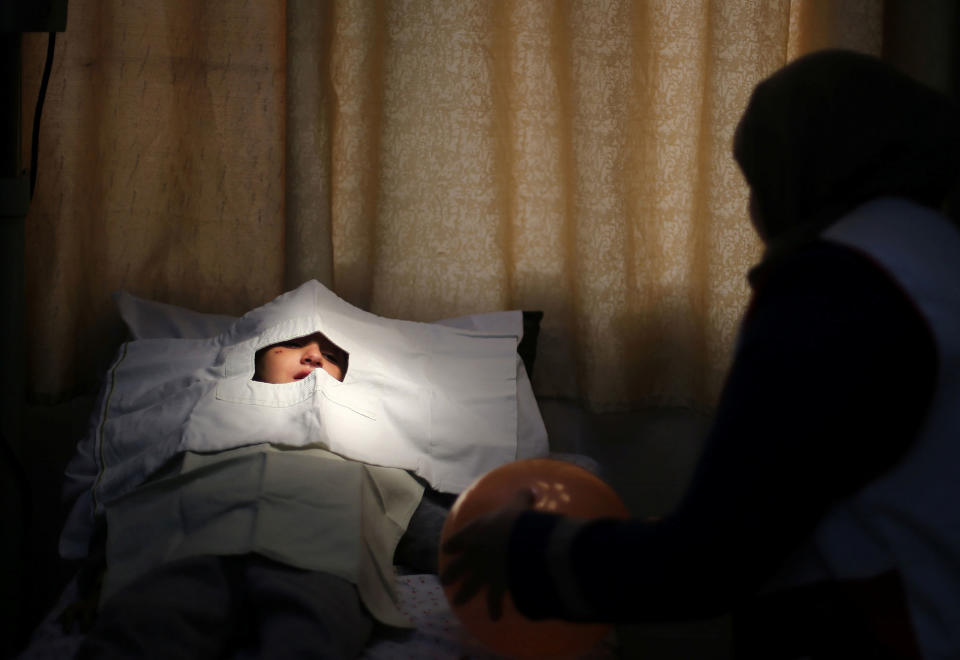 <p>Palestinian girl Jana Al-Bodi, 5, lies on a bed before nurses remove stitches over her eye at Al Awda Hospital, a private medical facility in the northern Gaza Strip, March 30, 2017. (Photo: Mohammed Salem/Reuters) </p>