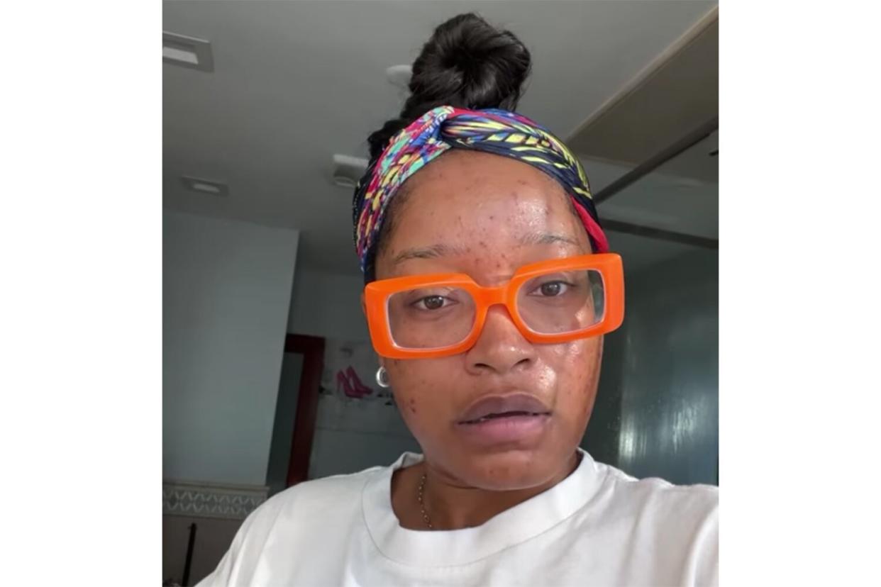 Keke Palmer Gets Emotional Over Acne Struggles in Vulnerable Make-Up Free Instagram