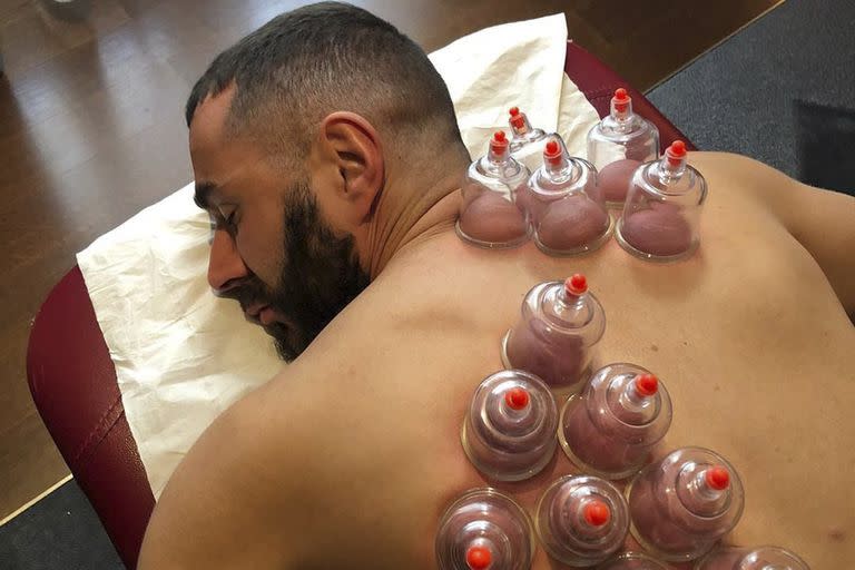 Benzema, en plena sesión de terapia de ventosas