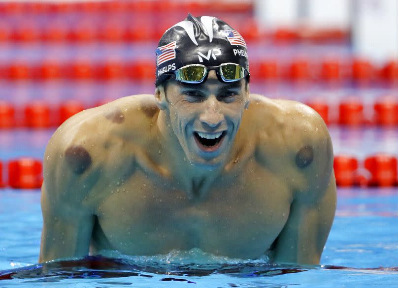 ARCHIVO - En esta foto del martes 9 de agosto de 2016 se ven marcas de ventosas en los hombros del estadounidense Michael Phelps