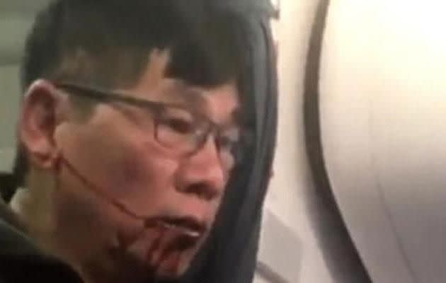 Pictures of Dr Dao bloodied and dazed have made headlines around the world. Photo: Twitter