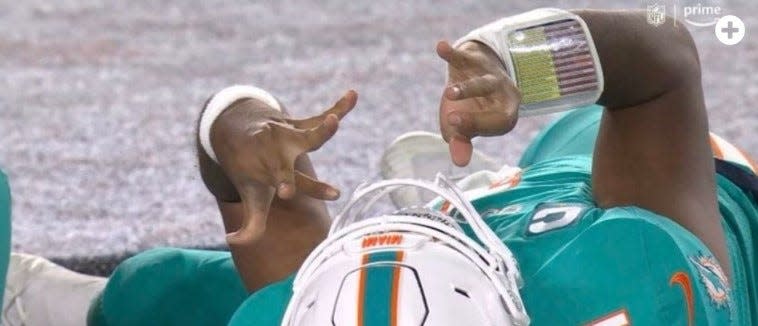 Miami Dolphins quarterback Tua Tagovailoa was knocked unconscious on Sept. 29 in a game against Cincinnati and displayed the so-called "fencing response" in his upper body. Experts say the fencing response likely indicates neurological disturbance unique from convulsion associated with forces of moderate magnitude imparted on the midbrain and can assist in guiding medical care after injury.