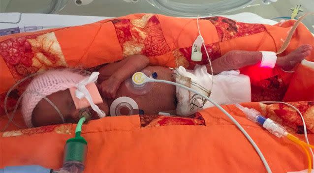 Paige was born just 10 days after her mother discovered she was pregnant. Photo: Yahoo UK