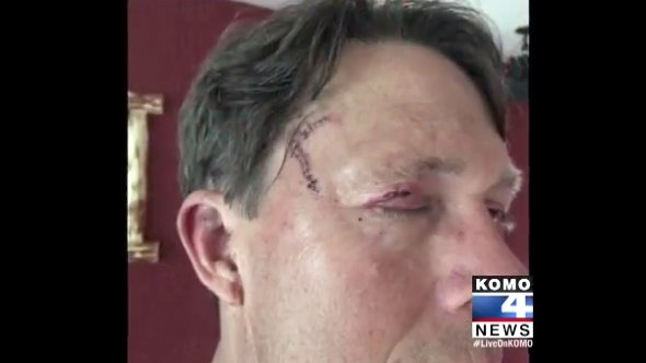 Man survives second bear attack in four years